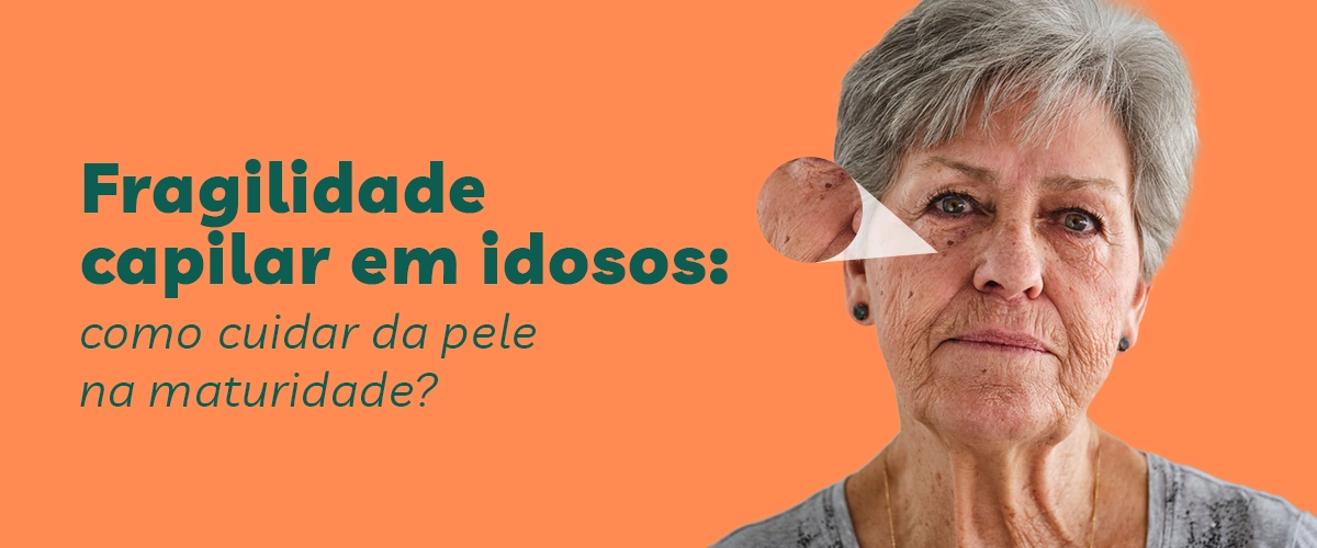 Fragilidade capilar em idosos